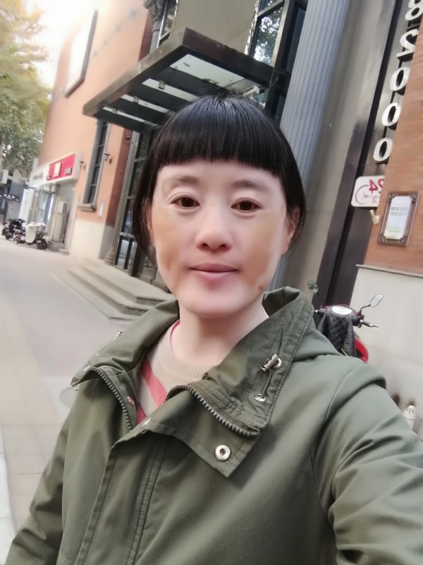 米儿的第一张照片--石家庄残疾人相亲网